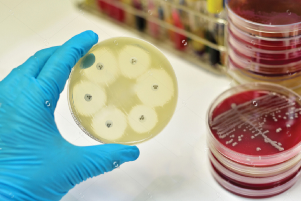 Microbiología Microbiología