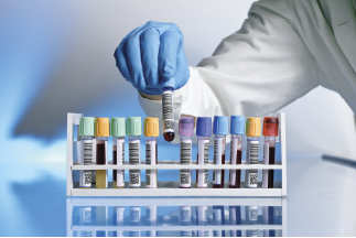 Material para envío de muestras Material para envío de muestras